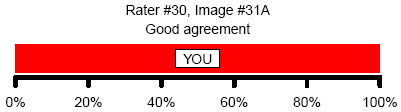 Figure 1. Good agreement with consensus