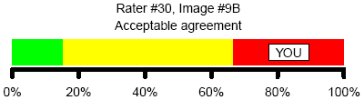Figure 3. Acceptable agreement with consensus