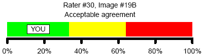 Figure 5. Acceptable agreement with consensus