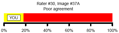Figure 6. Poor agreement with consensus