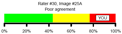 Figure 7. Poor agreement with consensus