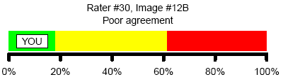 Figure 8. Poor agreement with consensus