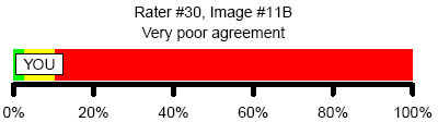 Figure 9. Very poor agreement with consensus