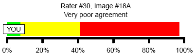 Figure 10. Very poor agreement with consensus
